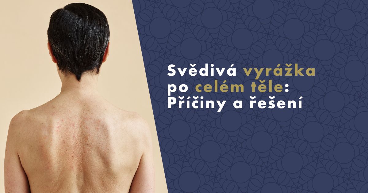 svediva-vyrazka-po-celem-tele (1)